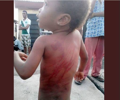 4-year-old girl gets brutally flogged for the flimsiest reason