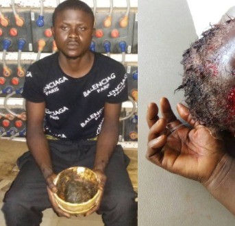 Graphic photos: Yahoo Boy attempts to kill his mother for money rituals in Lagos