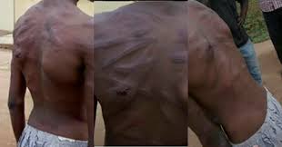 Boy brutalized by his uncle in Lagos